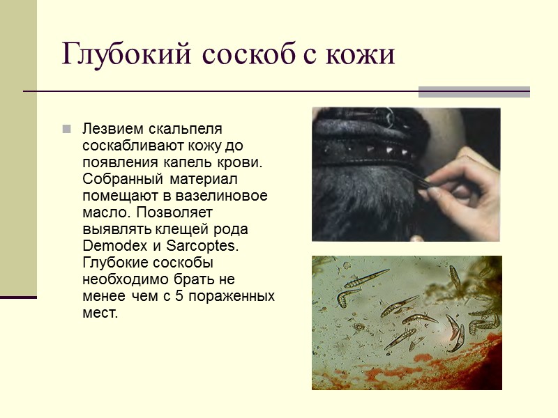 Глубокий соскоб с кожи  Лезвием скальпеля соскабливают кожу до появления капель крови. Собранный